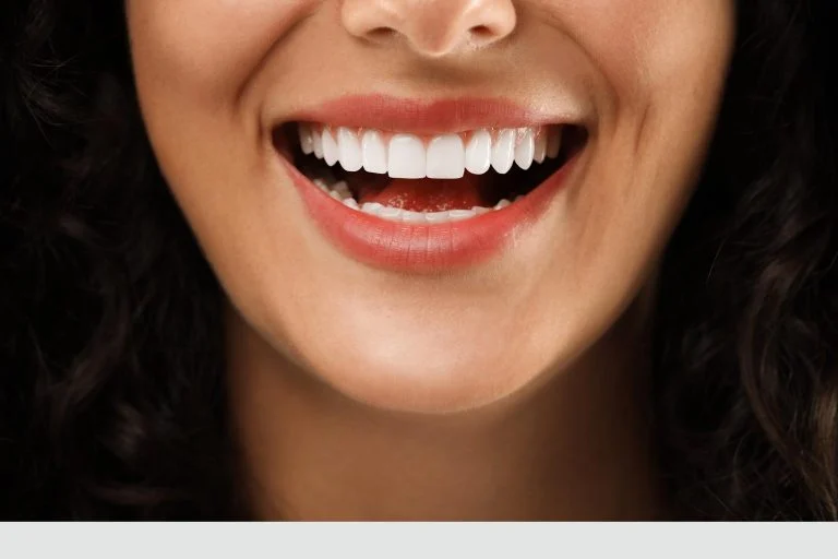 Cosmetic Dentistry for Gummy Smile