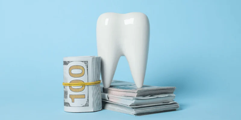 Cost of Dental Veneers