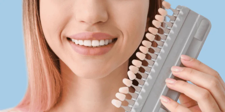 Porcelain Veneers Benefits