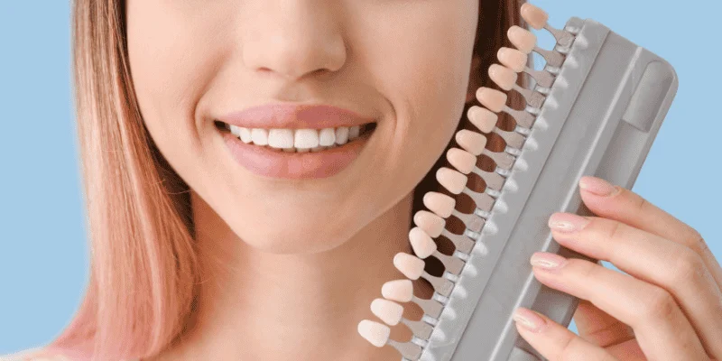 Porcelain Veneers Benefits
