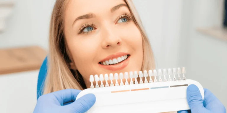 Porcelain Veneers Longevity