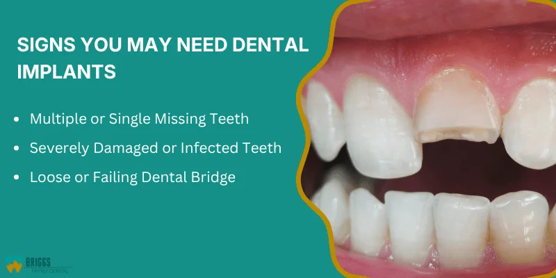 Recognizing When Dental Implants May Be Needed