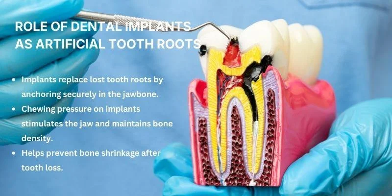Role of Dental Implants as Artificial Tooth Roots
