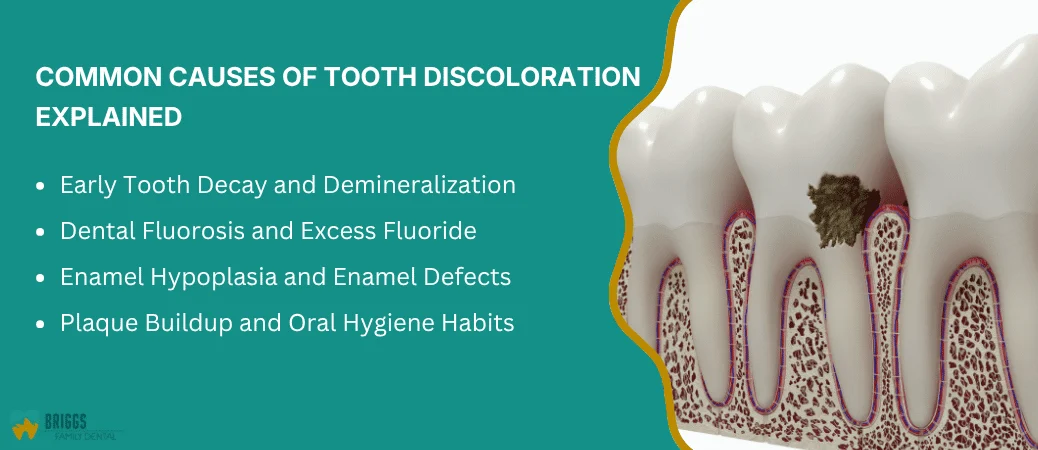 Root Causes Decay, Enamel Defects, and Fluorosis Explained