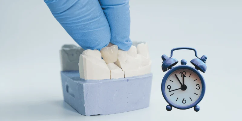 Same-Day Crowns Procedure