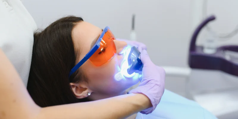 The chemistry behind teeth whitening
