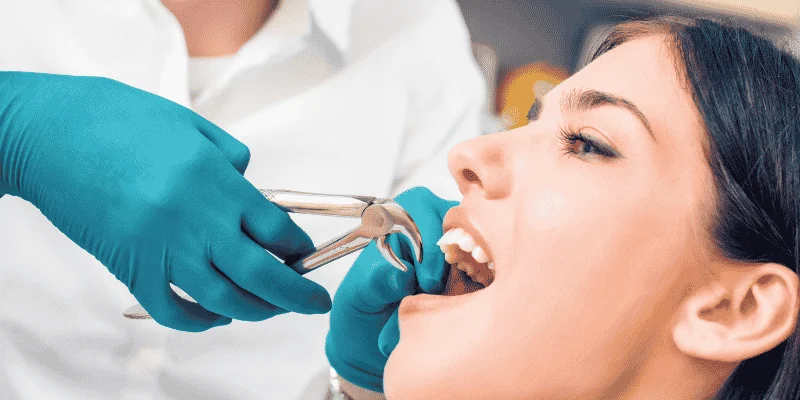 Tooth Extraction Versus Dental Implants