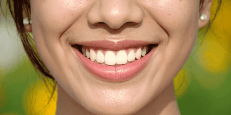 Types of Dental Bridges