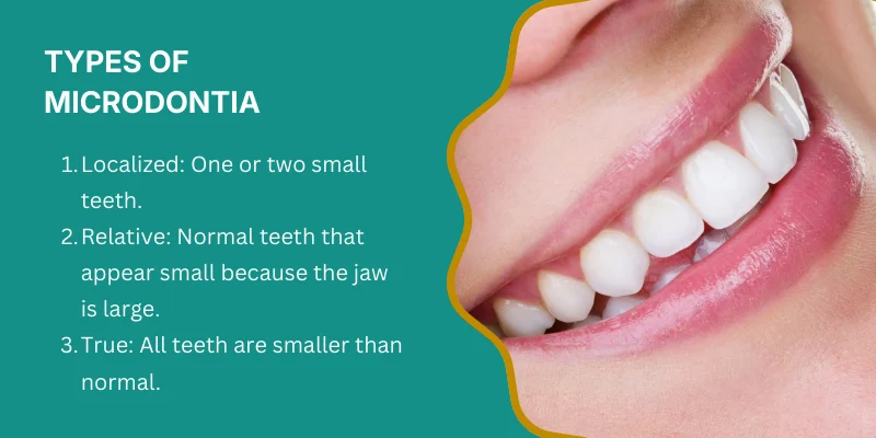 Types of microdontia