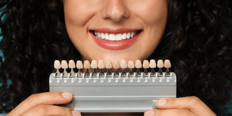 Veeners for small teeth