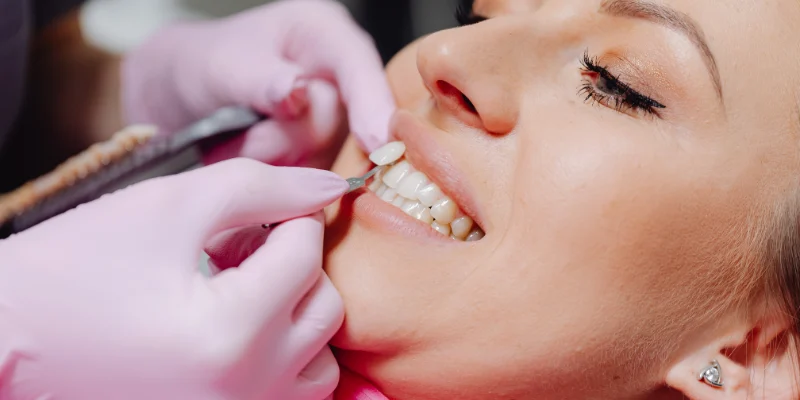 Veneers' suitability and candidacy