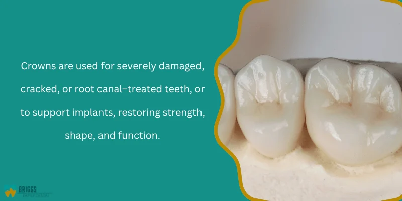 Why Dentists Recommend Crowns