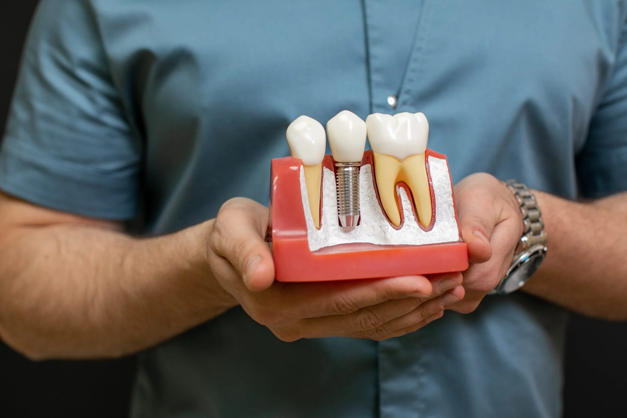 Same-Day Dental Implants with 3D Guided Surgery in New Market, VA